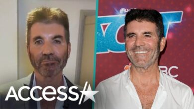 SAD NEWS: It is reported that Simon Cowell has a permanent “DEFORMATION” of the face and many other complications because he has done too many things…