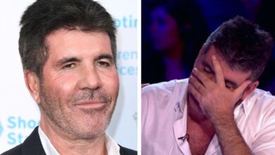 Simon Cowell “REVEALS” that his fans are extremely heartbroken that his face will be permanently deformed because of…